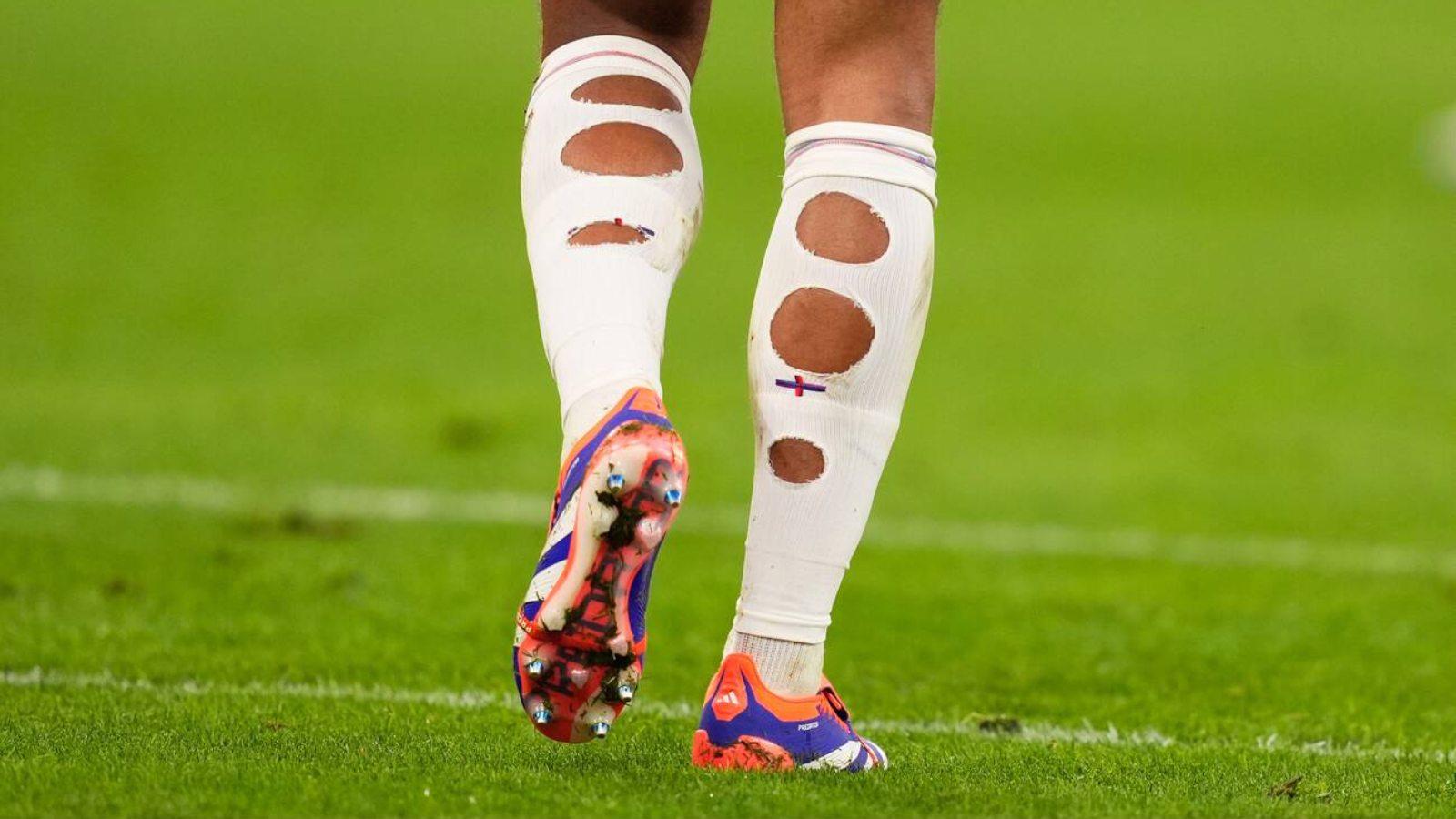 Dortmund, Germany. 11th July, 2024. England's Jude Bellingham socks during a semifinal match between Netherland and England at the Euro 2024 soccer tournament in Dortmund at Signal Iduna Park, Germany, Wednesday, July 10, 2024.Sport - Soccer . (Photo by Fabio Ferrari/LaPresse) England's Jude Bellingham socks during a semifinal match between Netherland and England at the Euro 2024 soccer tournament in Dortmund at Signal Iduna Park, Germany, Wednesday, July 10, 2024.